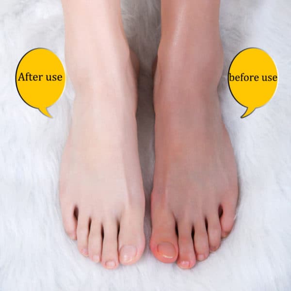 exfoliation des pieds – Image 5
